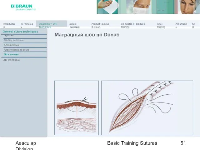 Basic Training Sutures Aesculap Division Матрацный шов по Donati General suture techniques