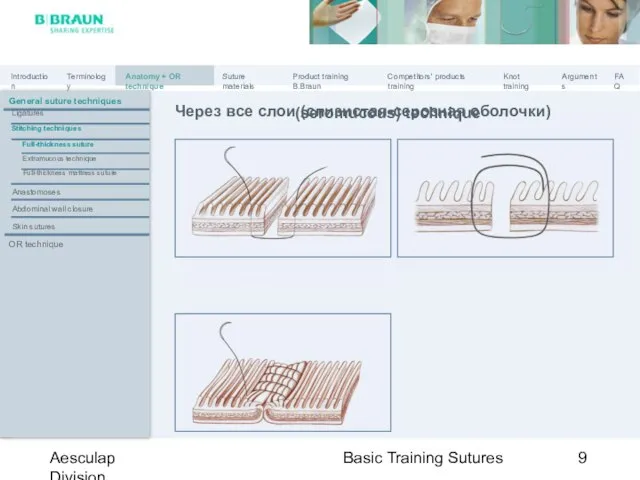 Basic Training Sutures Aesculap Division Через все слои (слизистая-серозная оболочки) General suture