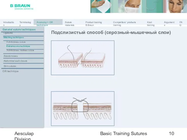 Basic Training Sutures Aesculap Division Подслизистый способ (серозный-мышечный слои) General suture techniques