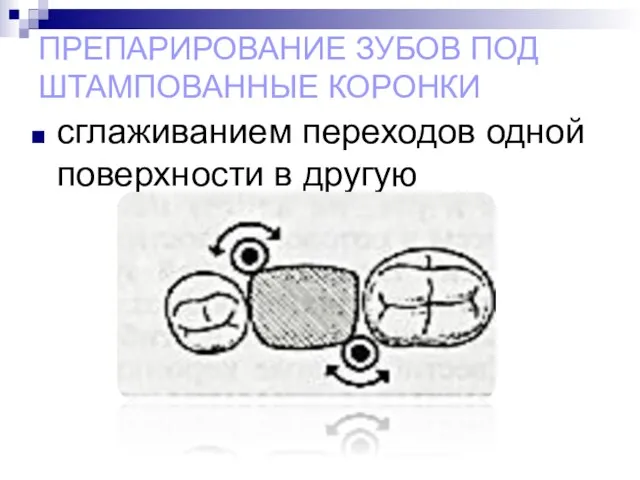 ПРЕПАРИРОВАНИЕ ЗУБОВ ПОД ШТАМПОВАННЫЕ КОРОНКИ сглаживанием переходов одной поверхности в другую