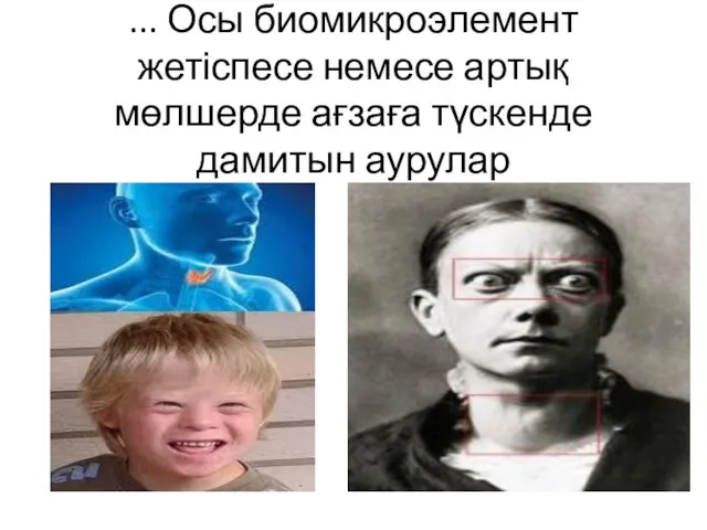 ... Осы биомикроэлемент жетіспесе немесе артық мөлшерде ағзаға түскенде дамитын аурулар