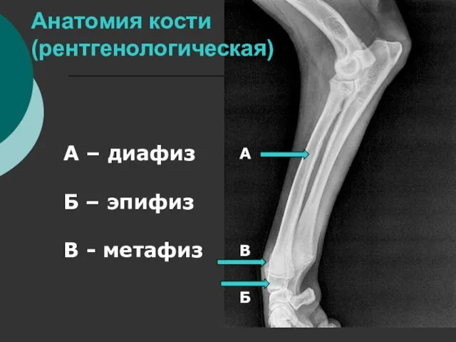 Анатомия кости (рентгенологическая) А Б В А – диафиз Б – эпифиз В - метафиз