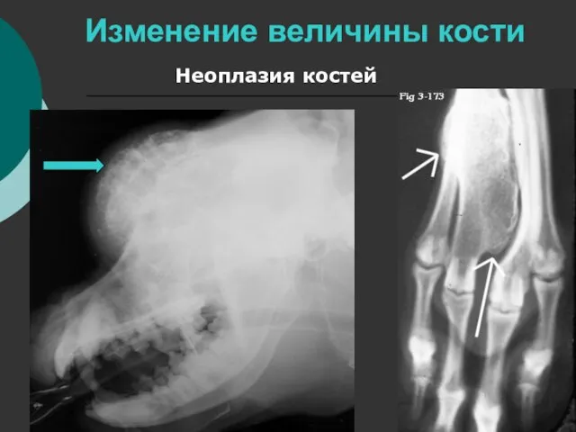 Изменение величины кости Неоплазия костей