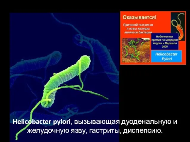 Helicobacter pylori, вызывающая дуоденальную и желудочную язву, гастриты, диспепсию.