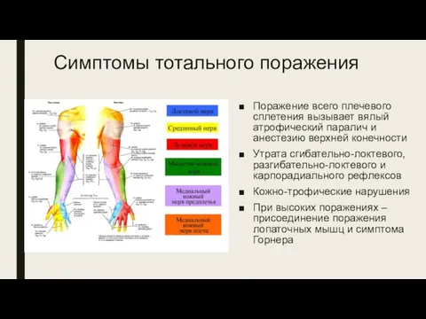 Симптомы тотального поражения Поражение всего плечевого сплетения вызывает вялый атрофический паралич и