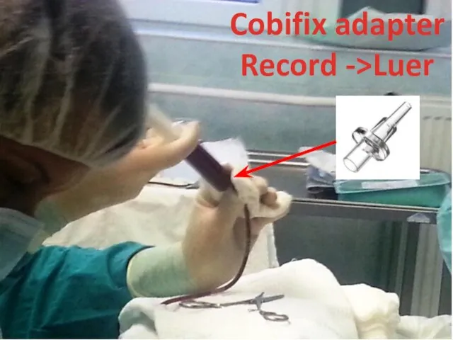 Cobifix adapter Record ->Luer