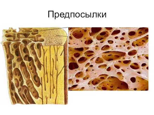 Предпосылки