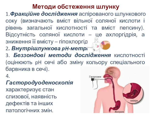 Методи обстеження шлунку 1.Фракційне дослідження аспірованого шлункового соку (визначають вміст вільної соляної