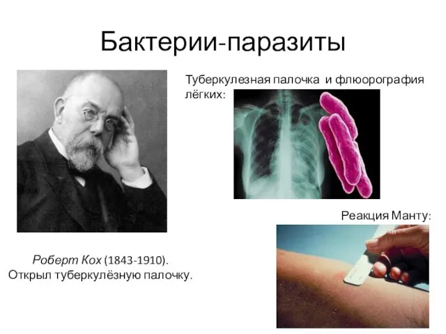 Бактерии-паразиты Роберт Кох (1843-1910). Открыл туберкулёзную палочку. Реакция Манту: Туберкулезная палочка и флюорография лёгких: