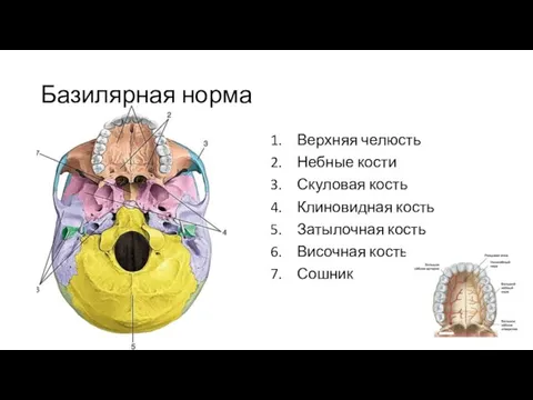 Базилярная норма Верхняя челюсть Небные кости Скуловая кость Клиновидная кость Затылочная кость Височная кость Сошник