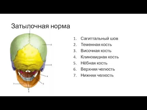 Затылочная норма Сагиттальный шов Теменная кость Височная кость Клиновидная кость Нёбная кость Верхняя челюсть Нижняя челюсть