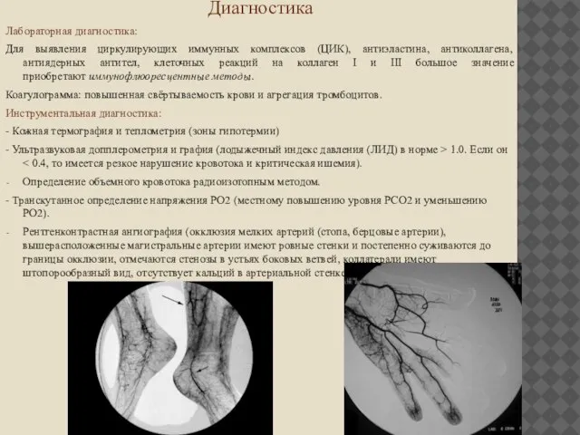 Диагностика Лабораторная диагностика: Для выявления циркулирующих иммунных комплексов (ЦИК), антиэластина, антиколлагена, антиядерных