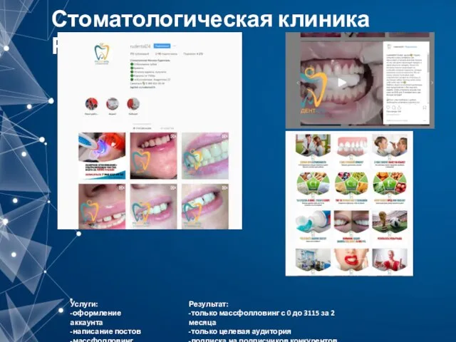 Стоматологическая клиника Руденталь Услуги: -оформление аккаунта -написание постов -массфолловинг Результат: -только массфолловинг