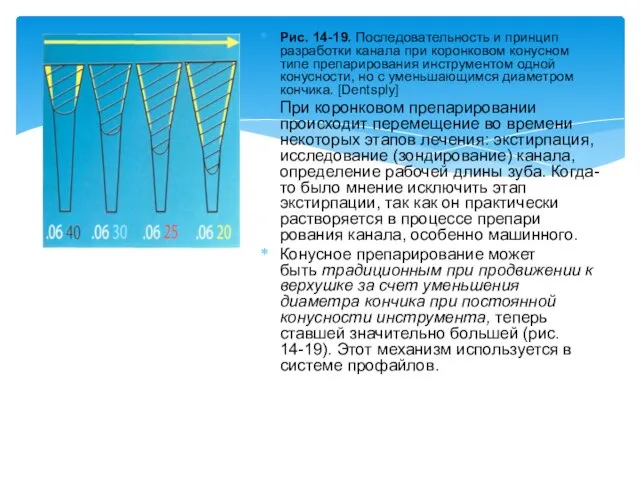 Рис. 14-19. Последовательность и принцип разработки канала при коронковом конусном типе препарирования