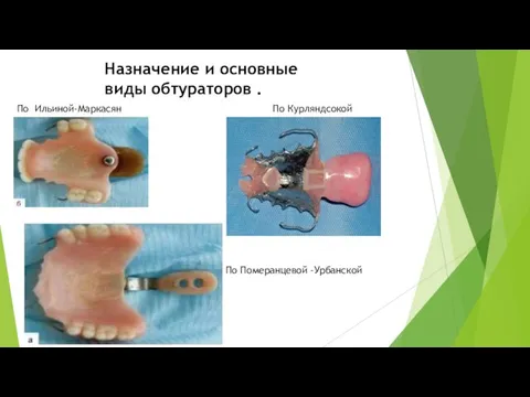 Назначение и основные виды обтураторов . По Ильиной-Маркасян По Курляндсокой По Померанцевой -Урбанской