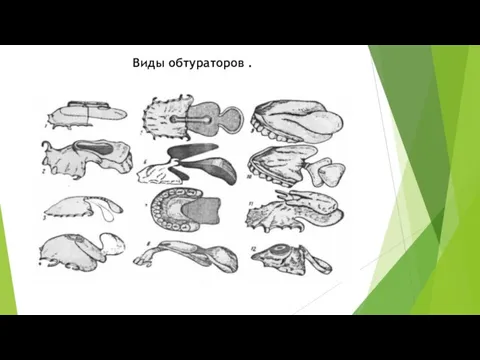 Виды обтураторов .