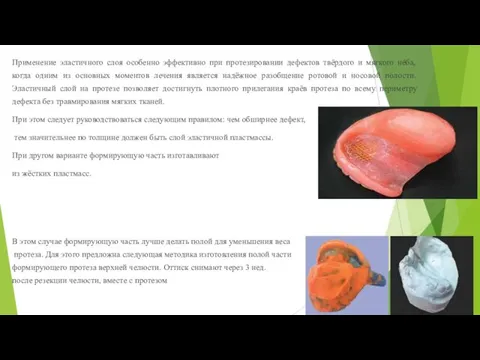 Применение эластичного слоя особенно эффективно при протезировании дефектов твёрдого и мягкого нёба,