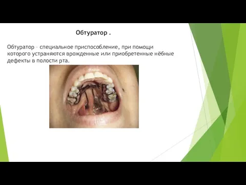 Обтуратор . Обтуратор – специальное приспособление, при помощи которого устраняются врожденные или