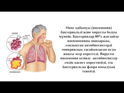 Өкпе қабынуы (пневмония) бактериальді және вирусты болуы мүмкін. Бактериялар 80% жағдайда пневмонияны