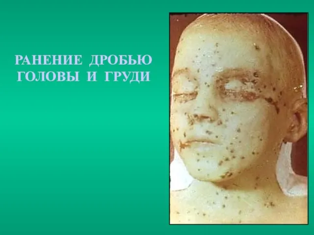 РАНЕНИЕ ДРОБЬЮ ГОЛОВЫ И ГРУДИ