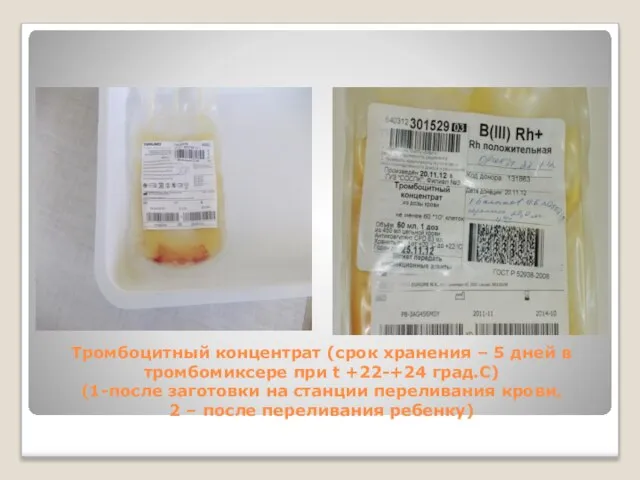Тромбоцитный концентрат (срок хранения – 5 дней в тромбомиксере при t +22-+24