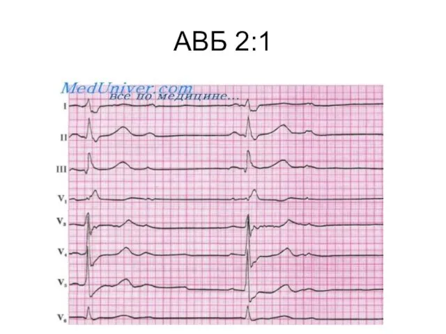 АВБ 2:1