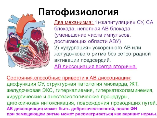 Патофизиология Два механизма: 1)«капитуляция» СУ, СА блокада, неполная АВ блокада (уменьшение числа