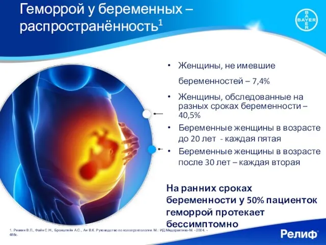 Геморрой у беременных – распространённость1 Женщины, не имевшие беременностей – 7,4% Женщины,