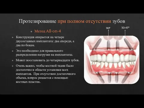 Протезирование при полном отсутствии зубов Метод All-on-4 Конструкция опирается на четыре двусоставных