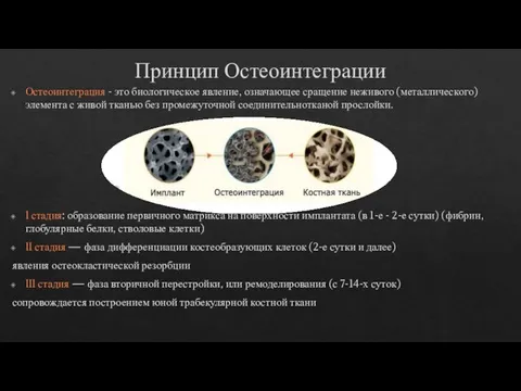 Принцип Остеоинтеграции Остеоинтеграция - это биологическое явление, означающее сращение неживого (металлического) элемента