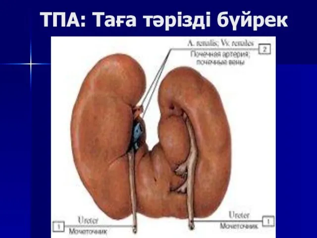 ТПА: Таға тәрізді бүйрек