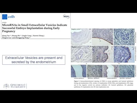 Extracellular Vesicles are present and secreted by the endometrium