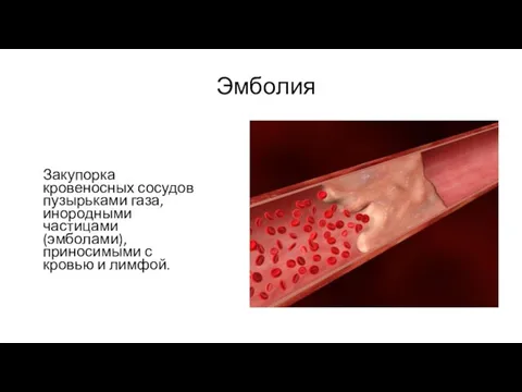 Эмболия Закупорка кровеносных сосудов пузырьками газа, инородными частицами (эмболами), приносимыми с кровью и лимфой.