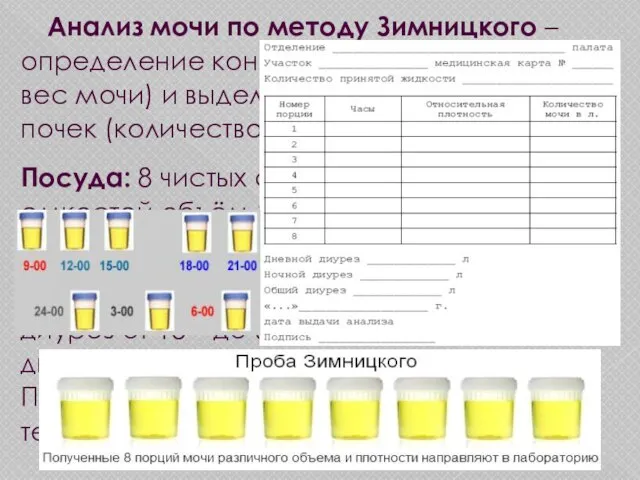 Анализ мочи по методу Зимницкого – определение концентрационной (удельный вес мочи) и