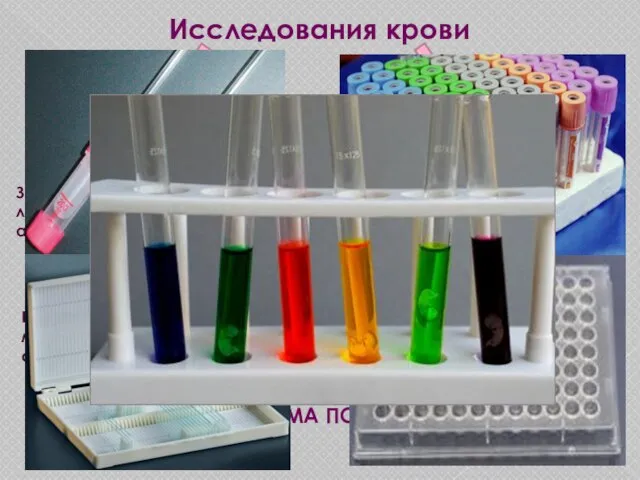 Исследования крови КЛИНИЧЕСКИЕ БИОХИМИЧЕСКИЕ Забор крови производит лаборант, например:общий анализ крови (ОАК).