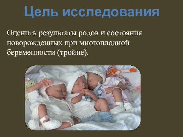 Цель исследования Оценить результаты родов и состояния новорожденных при многоплодной беременности (тройне).