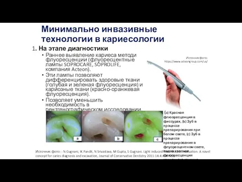 Минимально инвазивные технологии в кариесологии 1. На этапе диагностики Раннее выявление кариеса