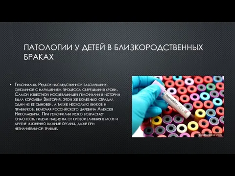 ПАТОЛОГИИ У ДЕТЕЙ В БЛИЗКОРОДСТВЕННЫХ БРАКАХ Гемофилия. Редкое наследственное заболевание, связанное с