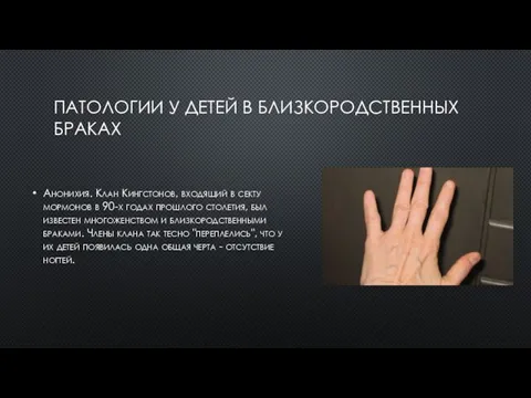 ПАТОЛОГИИ У ДЕТЕЙ В БЛИЗКОРОДСТВЕННЫХ БРАКАХ Анонихия. Клан Кингстонов, входящий в секту