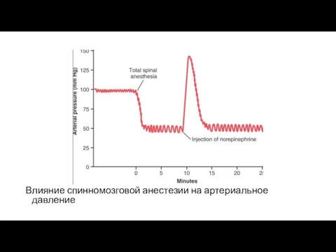 Влияние спинномозговой анестезии на артериальное давление