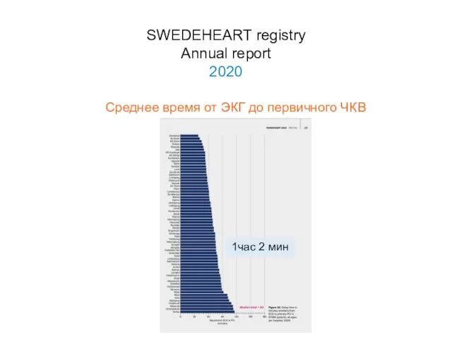 SWEDEHEART registry Annual report 2020 Среднее время от ЭКГ до первичного ЧКВ 1час 2 мин