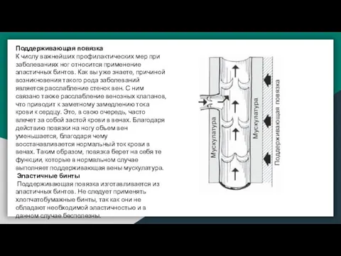 Поддерживающая повязка К числу важнейших профилактических мер при заболеваниях ног относится применение