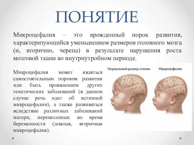 ПОНЯТИЕ Микроцефалия – это врожденный порок развития, характеризующийся уменьшением размеров головного мозга