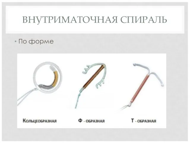 ВНУТРИМАТОЧНАЯ СПИРАЛЬ По форме