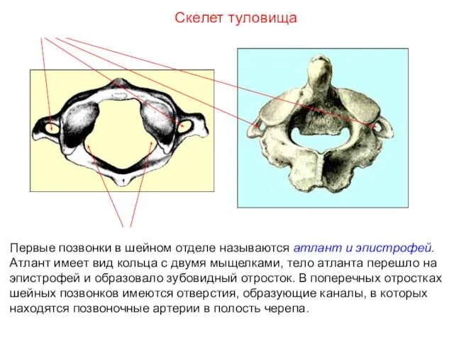 Первые позвонки в шейном отделе называются атлант и эпистрофей. Атлант имеет вид