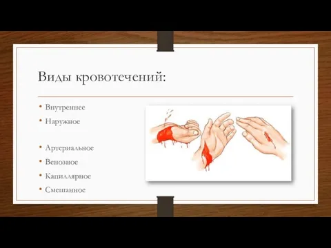 Виды кровотечений: Внутреннее Наружное Артериальное Венозное Капиллярное Смешанное