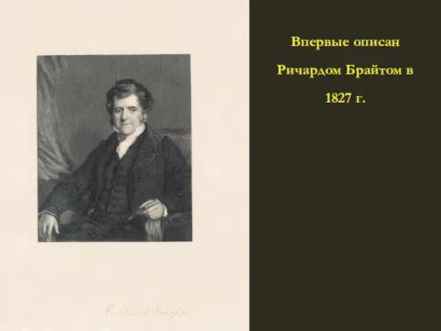 Впервые описан Ричардом Брайтом в 1827 г.