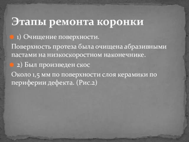 1) Очищение поверхности. Поверхность протеза была очищена абразивными пастами на низкоскоростном наконечнике.