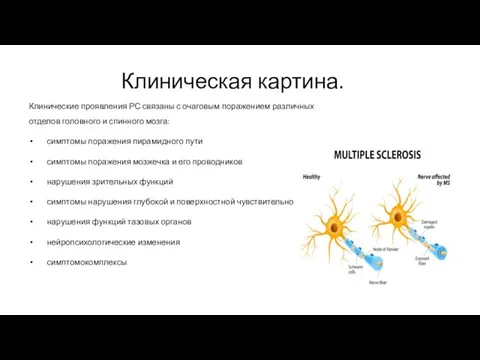 Клиническая картина. Клинические проявления РС связаны с очаговым поражением различных отделов головного