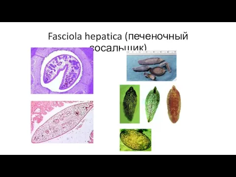 Fasciola hepatica (печеночный сосальщик)